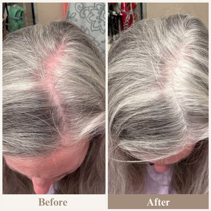ElevaHair™ Premium Hair Cover Up Powder