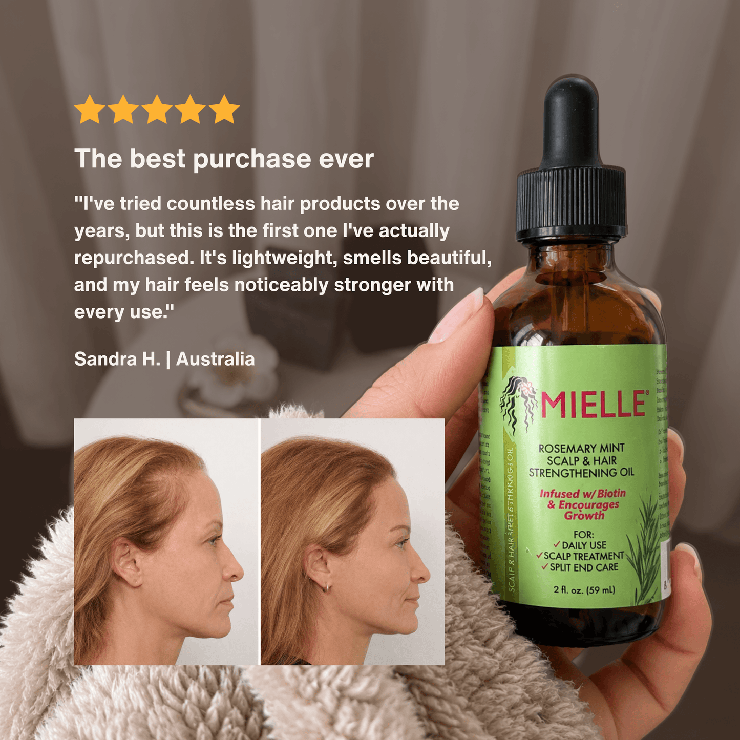 ElevaHair™ Rosemary Scalp & Hair Strengthening Oil