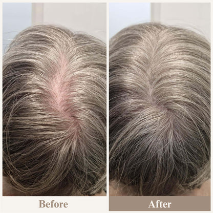 ElevaHair™ Premium Hair Cover Up Powder