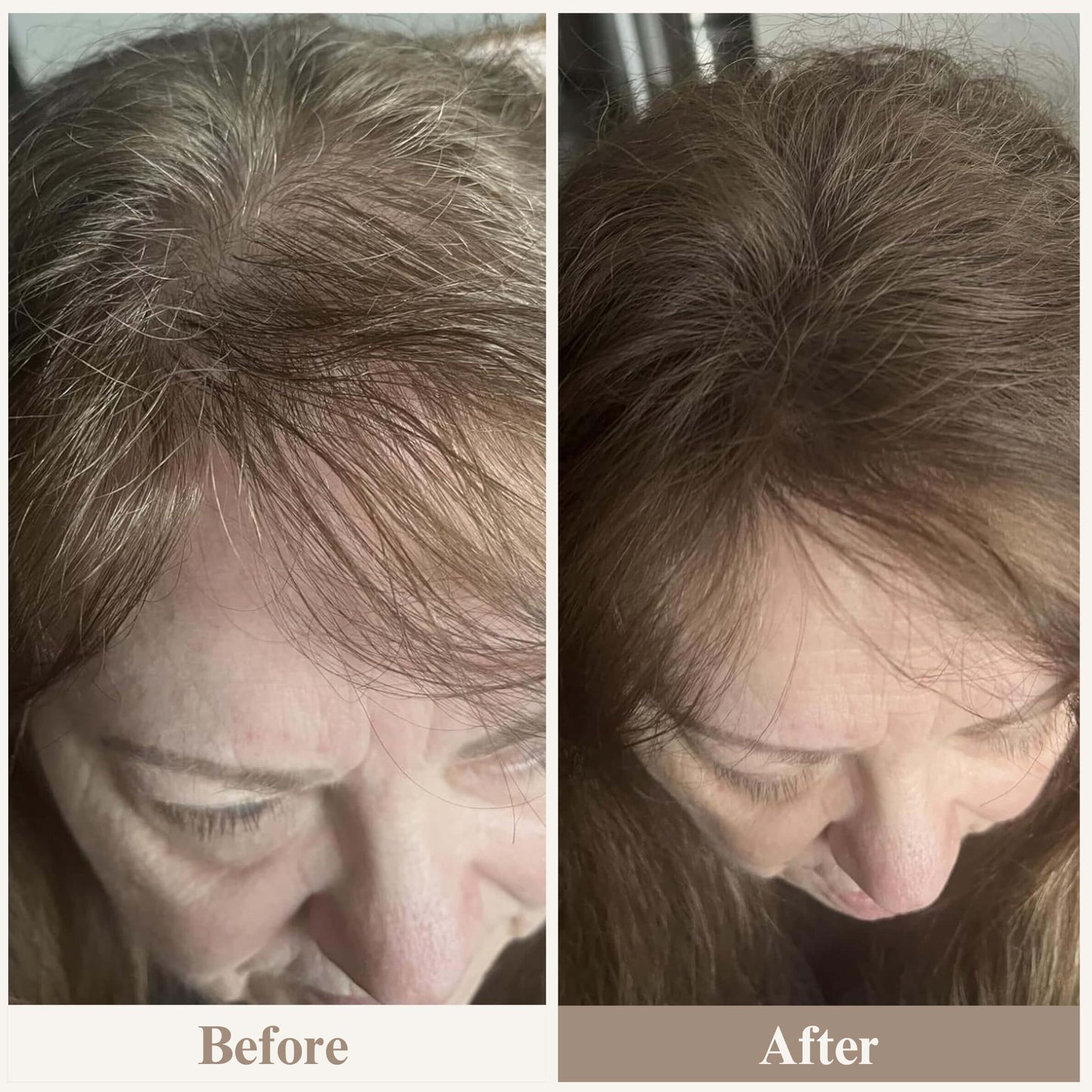 ElevaHair™ Premium Hair Cover Up Powder