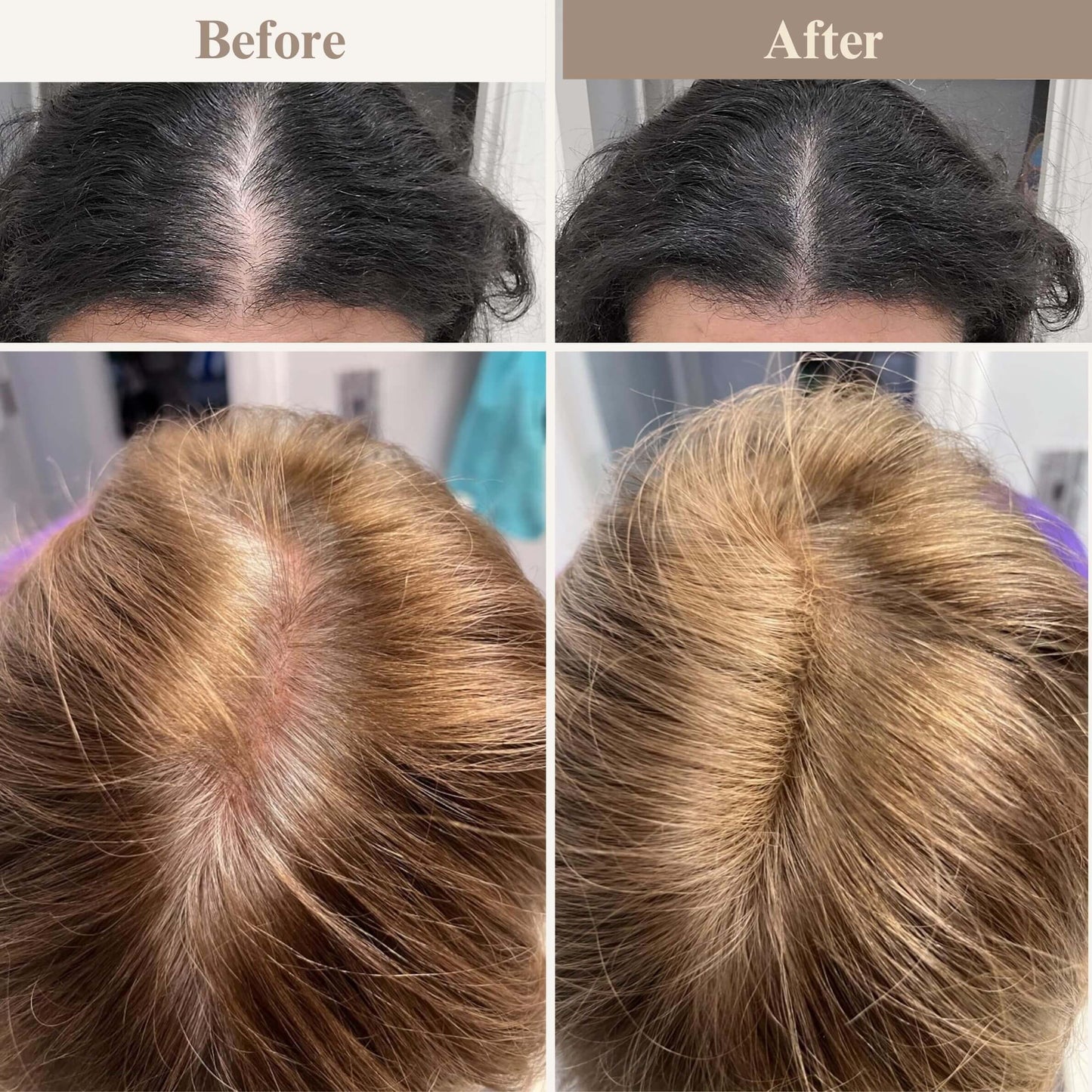 ElevaHair™ Premium Hair Cover Up Powder
