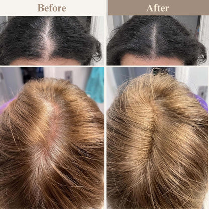 ElevaHair™ Premium Hair Cover Up Powder