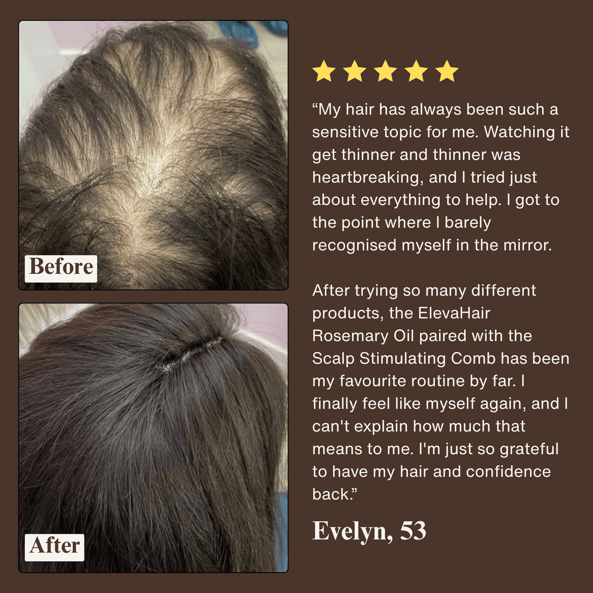 ElevaHair™ Rosemary Scalp & Hair Strengthening Oil
