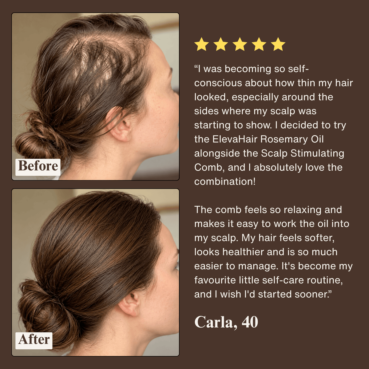 ElevaHair™ Rosemary Scalp & Hair Strengthening Oil