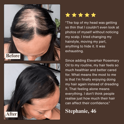 ElevaHair™ Rosemary Scalp & Hair Strengthening Oil